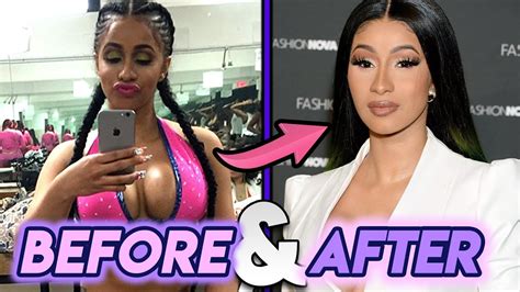 Cardi B Before And After Plastic Surgery Transformation Youtube