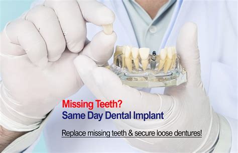 It is a dental procedure that allows you to repair your infected tooth and saves you from tooth extraction. Best Dental Implants Dubai | Same Day Implants Dubai ...