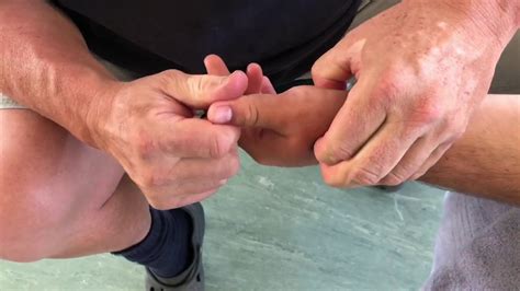 How To Prevent Arthritis Hand Reflexology Finger Massage With Tools Brandon Working On Skyler
