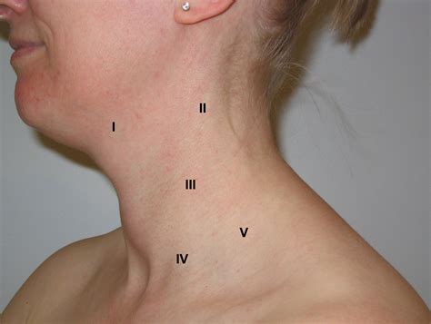 Neck Lymph Node Levels Neck Dissection Lymph Nodes In The Neck Have