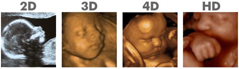 3d4d Ultrasounds Mother Nurture Ultrasound