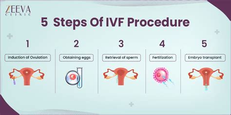 Ivf Procedure Step By Step Guide Zeeva Clinic