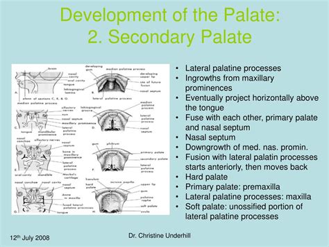 Ppt Orthodontic Management Of Cleft Lip And Palate Patient Powerpoint