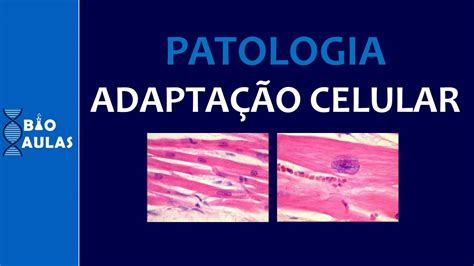 Adapta O Celular Hipertrofia Hiperplasia Hipotrofia Metaplasia