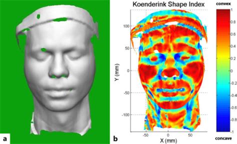 Computer Generated Facial Measurements For Orthodontics Naked Images Comments