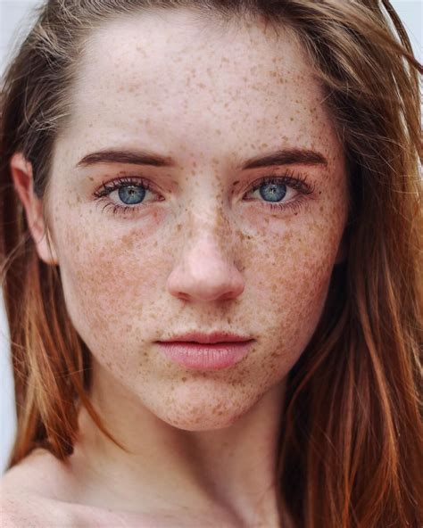 Truly Captivating In 2019 Beautiful Freckles Freckles