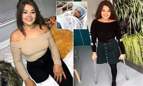 Teen With Incurable Bone Cancer Ditches Her Prosthetic Leg Daily Mail