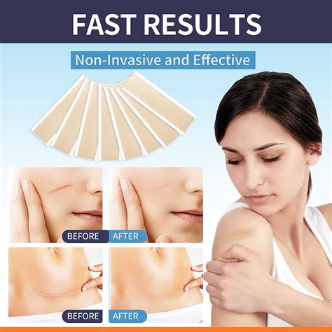 Buy Silicone Scar Sheets 8 Packscar Away Strips For Scars Keloidc