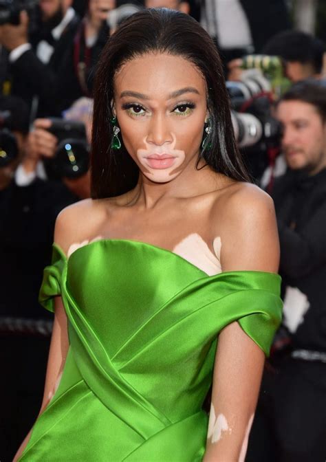 The Hottest Winnie Harlow Photos Around The Net 12thblog