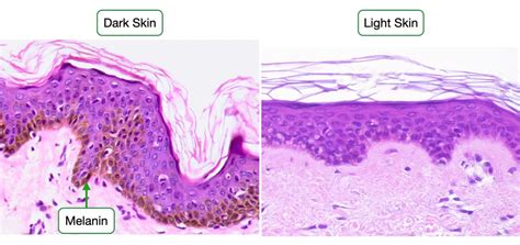 Histology Of Skin Lab