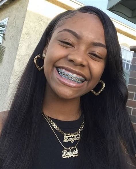 Pin By Lay 🤪‼️ On Braceface Human Hair Extensions Cute Braces Brazilian Straight Human Hair