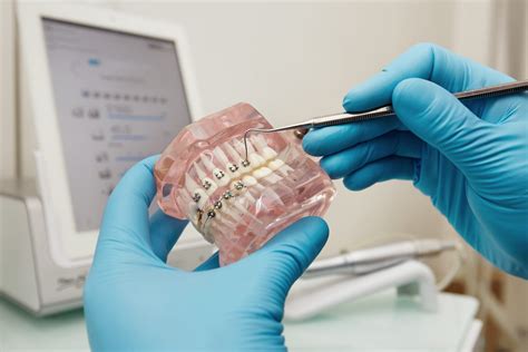 Orthodontic treatments - Sofia Smile Clinic
