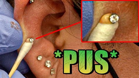 squeezing pus out of her ear gross youtube