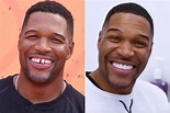Michael Strahan says goodbye to the gap in his teeth