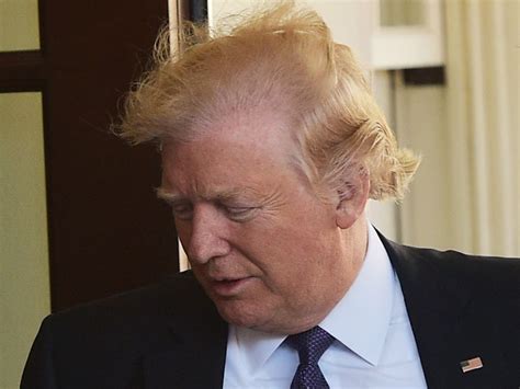 Scalp Reduction Surgery And Just For Men Let S Dig Into Donald Trump S Hair National Post