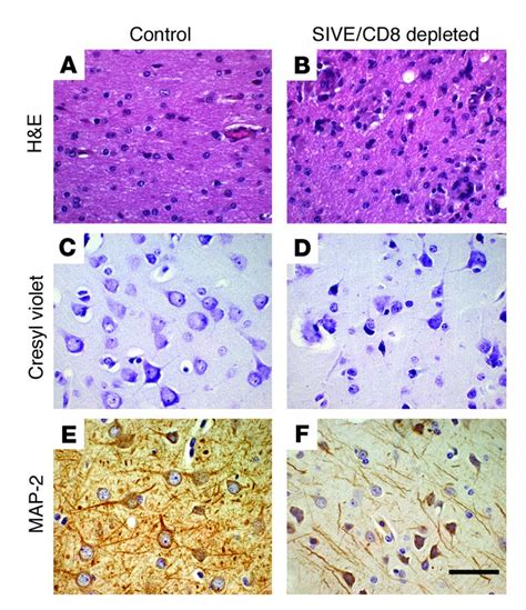 Jci Magnetic Resonance Spectroscopy Reveals That Activated Monocytes