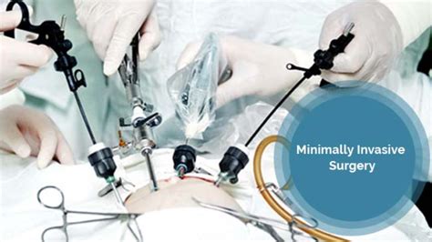 Advantages Of Minimally Invasive Surgery