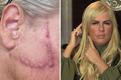 Glamour Model Breaks Down After Botched Surgery Daily Star