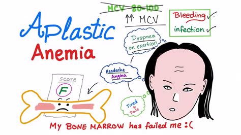 Symptoms Of Aplastic Anemia Health Blog