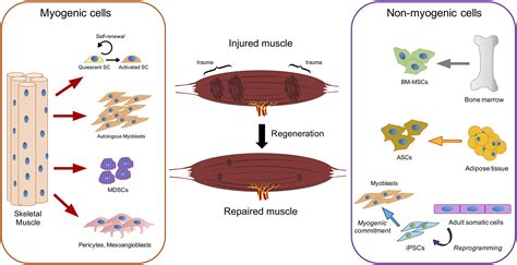 Cell Therapy To Improve Regeneration Of Skeletal Muscle Injuries Qazi