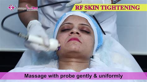 Radio Frequency Rf Skin Tightening Sakhiya Skin Clinic Youtube