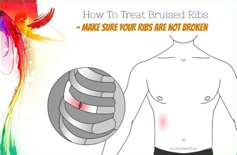 17 Tips How To Treat Bruised Ribs From A Fall Or Coughing Fast