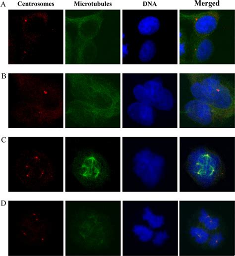 Interphase in the largest biology dictionary online. Representative examples of normal interphase and aberrant ...