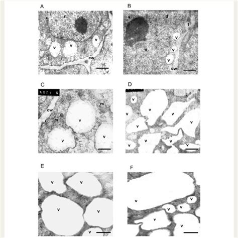 Electron Micrographs Of Hypocotyl A C E F And Radicle B D Cells