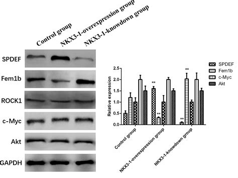 Frontiers Differential Expression Profile Of Lncrna In Glioma Cells