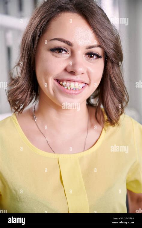 Portrait Of Cheerful Woman With Orthodontic Brackets On Teeth Smiling To Camera Joyful Woman