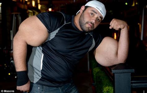 Informatica Meet The Real Life Popeye With 31 Inch Biceps ‘big Mo
