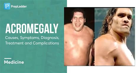 Acromegaly Causes Symptoms Risk Factors Diagnosis Treatment And