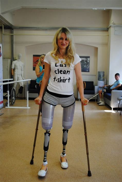 Amputee Legs Stumps And Prostheses Female Cyborg Leg Prosthesis