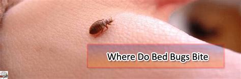 How Bed Bugs Bites Look Like With Picture And How To Treat It