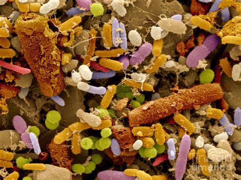 Bacteria In Human Feces Photograph By Scimat Pixels