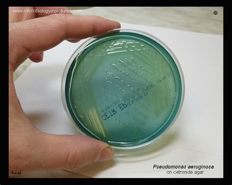 Cetrimide Agar Green Color Of Pseudomonas Aeruginosa Pigment On