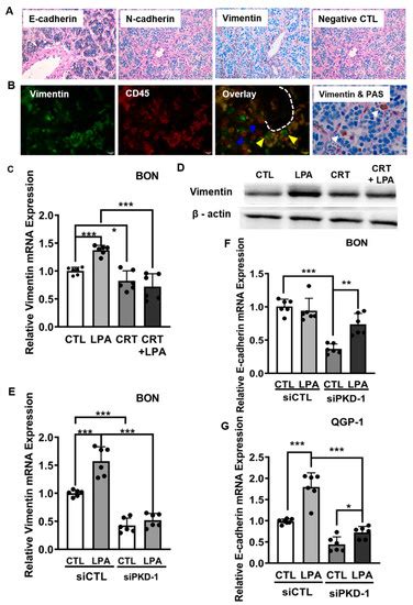 Cells Free Full Text Protein Kinase D1 Signaling In Cancer Stem