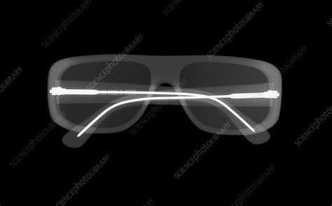 Sunglasses X Ray Stock Image F030 6203 Science Photo Library