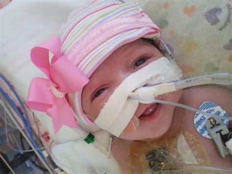 Girl Born With Heart Outside Her Body Survives Against All Odds