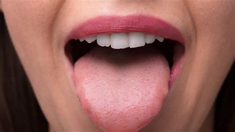 This Is What Really Causes A Hairy Tongue