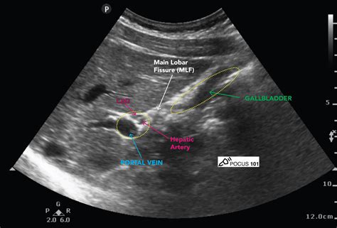 Abdominal Ultrasound Made Easy Step By Step Guide Pocus 101