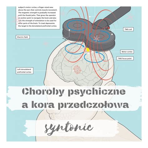 Neurodynamika Kliniczna Likwidacja Bólu Syntonic Szkolenia Oraz