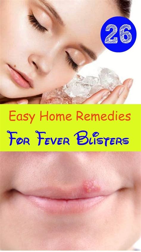 Home Remedies Store • 26 Easy Home Remedies For Fever Blisters Home