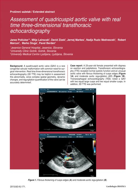 Pdf Assessment Of Quadricuspid Aortic Valve With Real Time Three