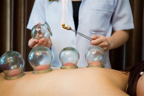 Cupping Therapy Ancient And Unique Way To Treat Your Body