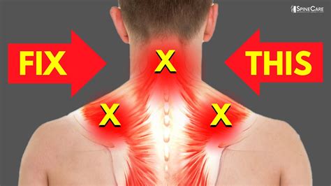 How To Fix A Sore Neck And Shoulders In Seconds Youtube