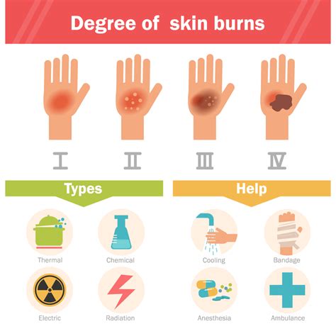 Another contributing factor to burn severity is how much of the body. Initial Management of Thermal Burn Injuries
