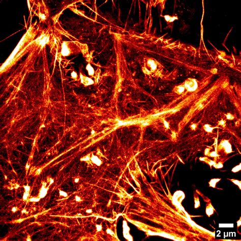 Microscope Super Resolution Simsmlm Elyra 7 Research Institut Pasteur