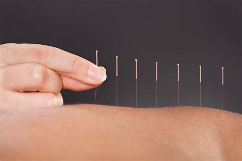 What Is Acupuncture How Acupuncture Heals Your Body The Healthy