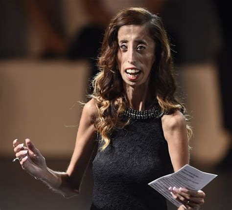 World’s Ugliest Woman Her Inspiring Story And Impact Articlesvally